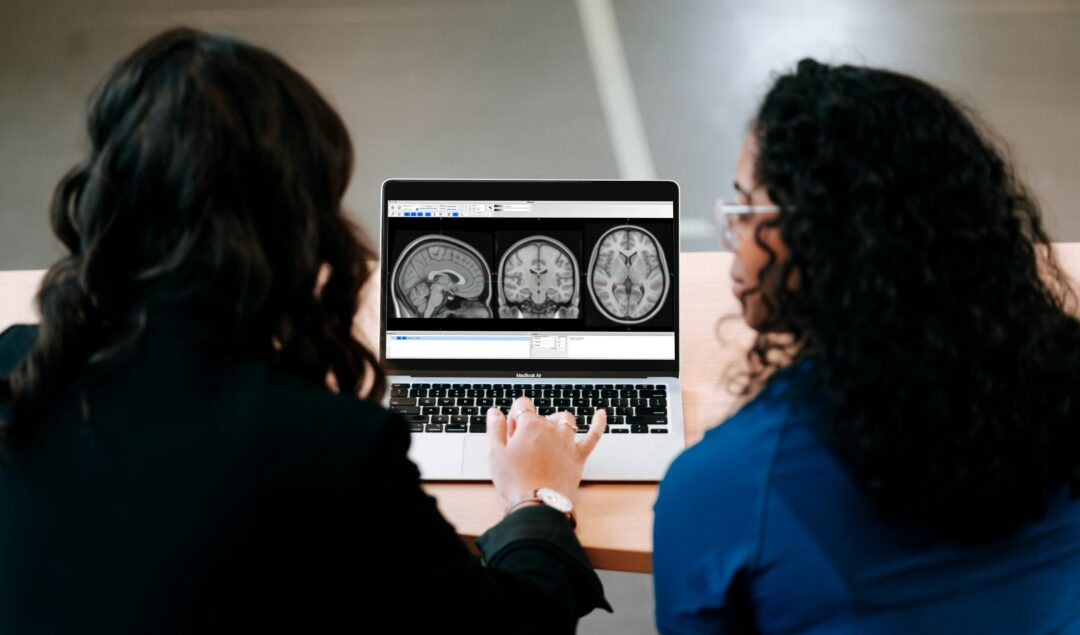 Women looking at brain scan