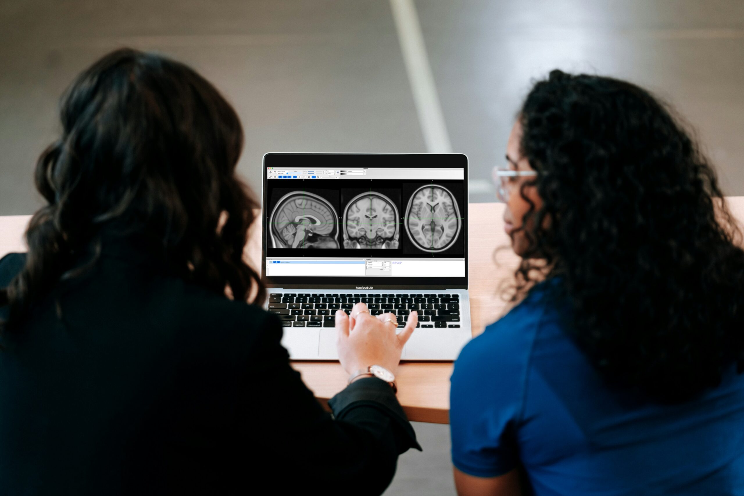 Trump’s DEI Crackdown Threatens Alzheimer’s Research